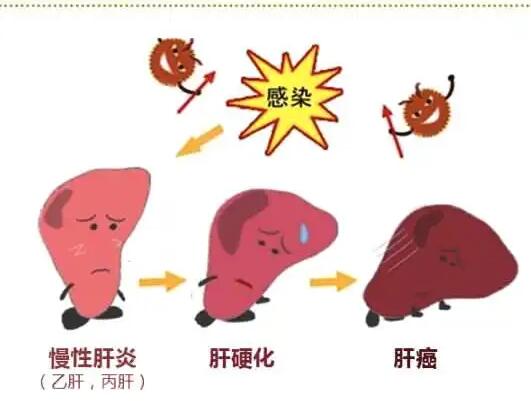 微量元素檢測儀廠家提醒肝髒疾病治不好？要了解是否含鐵食物攝入多